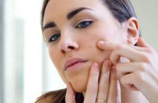 Dùng kem chống nắng bị nổi mụn