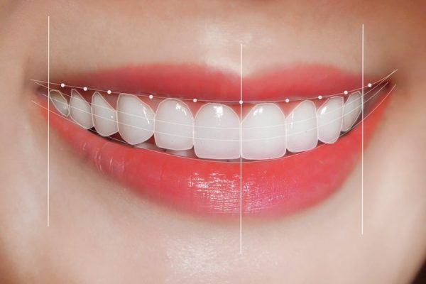 Cách nhận biết một hàm răng đẹp là như thế nào đó chính là dựa vào hình thể của răng.