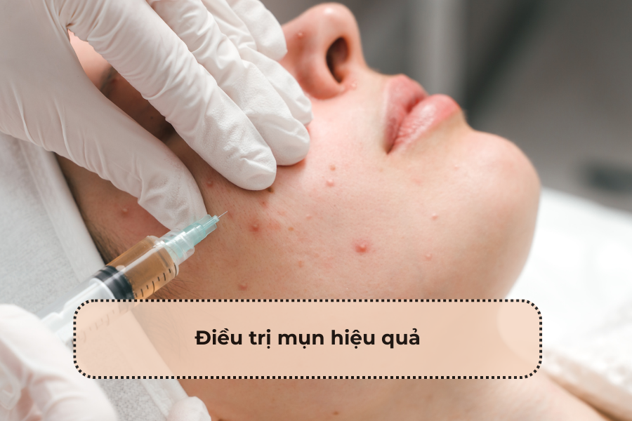 Công dụng của Maxxacne – Tìm hiểu hiệu quả điều trị mụn và chăm sóc da