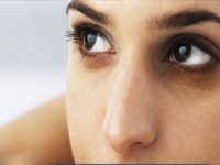 4 loại kem trị thâm quầng mắt hiệu quả và an toàn nhất